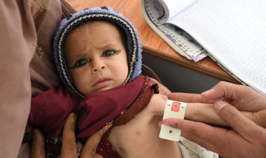 ملګري ملتونه: افغانستان کې پر خوارځواکۍ اخته ماشومانو وضعیت د اندېښنې وړ دی