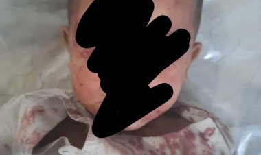 په سنګین ولسوالۍ کي د زړې مرمۍ د چاودني له امله دوه ماشومان ژوبل سوي دي.